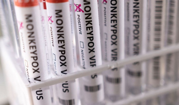 Ministério da Saúde confirma mais dois casos de varíola dos macacos 